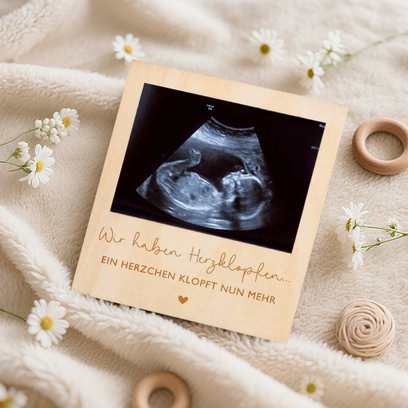 Ultrasound Pregnancy Announcem - مراجعة Photo Booth Frame وسعره